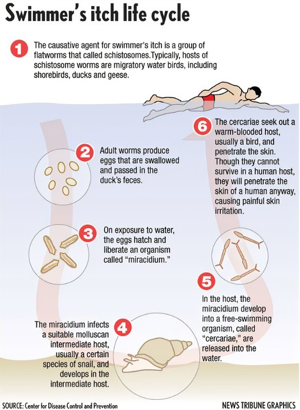 Chlorine Rash & Swimmer's Itch: Pictures, Symptoms, & Treatment